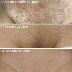 Design sem nome (18)